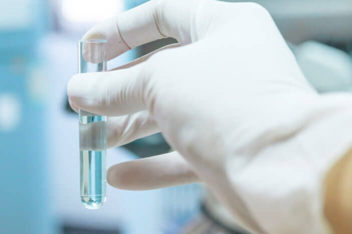 Close-up of glass tube with blue fluid in scientist hand during medical test