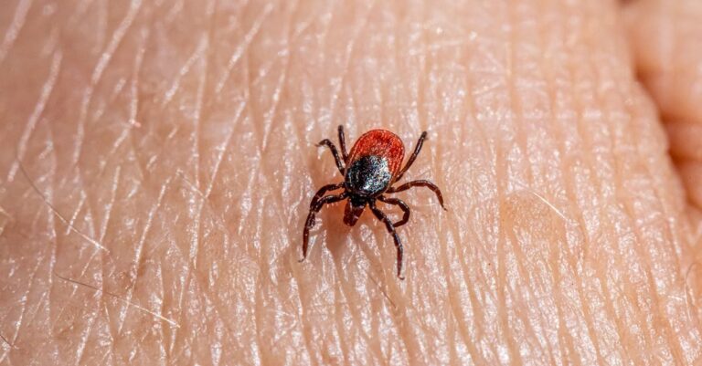 10 Best Insect Bite Relief Kits for Outdoor Safety That Keep Everyone Safe